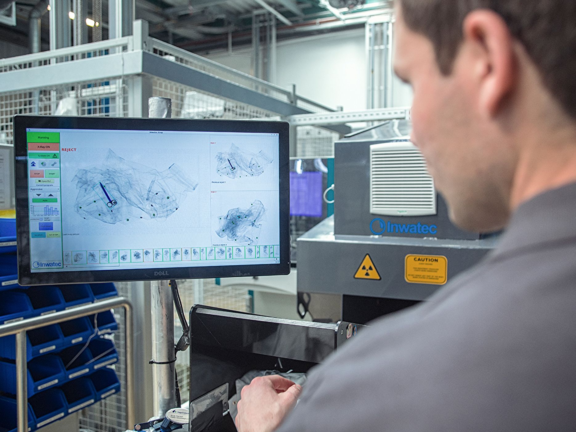 X-ray tussenbeeld